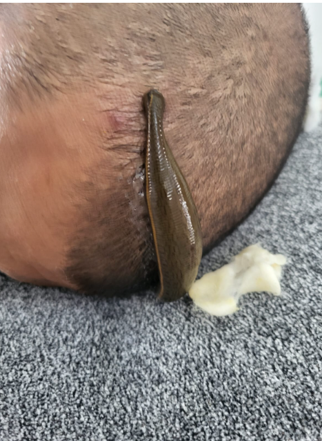 Moment of Care